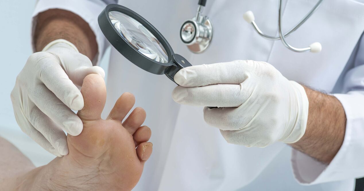 Der Arzt untersucht die Füße auf Nagelpilz.
