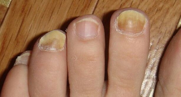 Ändern Sie die Farbe und die Nagelstruktur