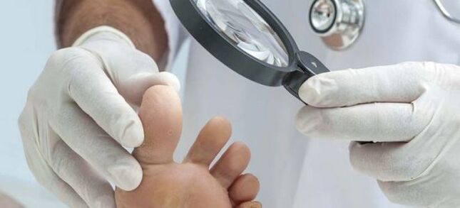 Untersuchungen vor Beginn der Pilzbehandlung.