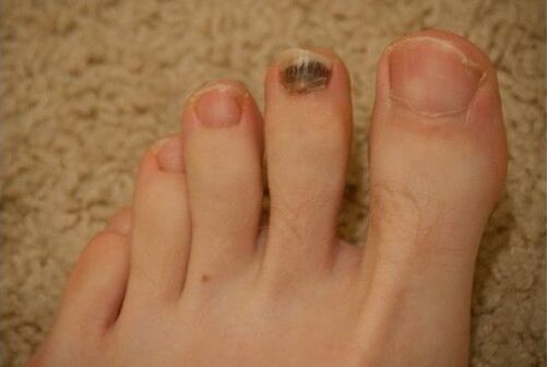 Verwendung oraler und topischer Medikamente.